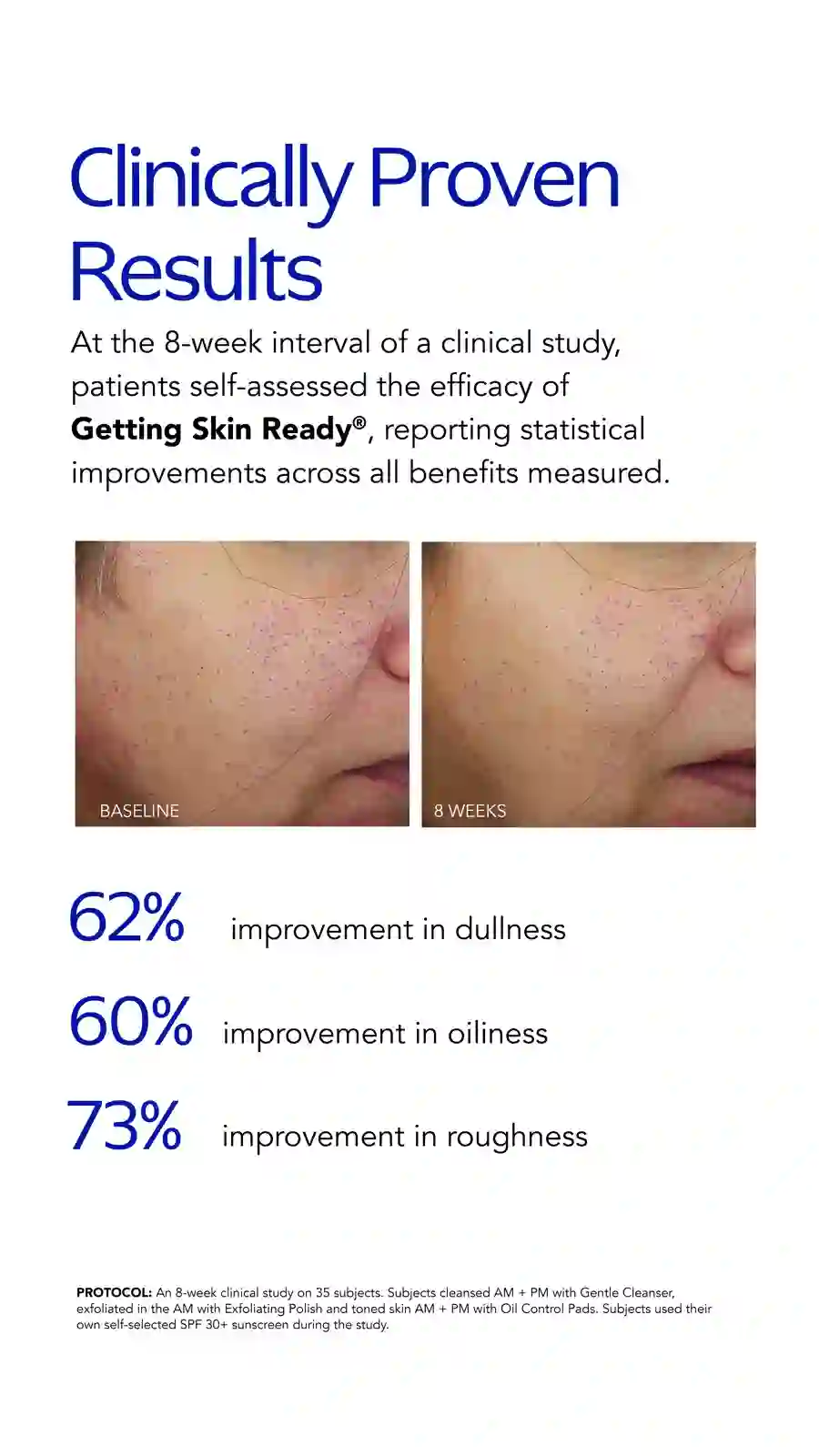 Clinical results of the Getting Skin Ready® routine in an 8-week study (ZO® Skin Health).